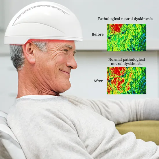Máquina de terapia de luz infrarroja con casco de neuroestimulación Suyzeko para terapia de fotobiomodulación